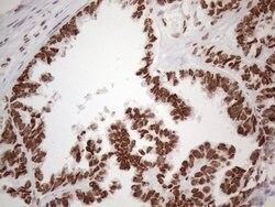 HNRNPL Monoclonal Antibody (OTI4E5), TrueMAB , OriGene 100 &mu;L; Unconjugated:Antibodies,