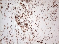 HNRNPL Monoclonal Antibody (OTI4E5), TrueMAB , OriGene 100 &mu;L; Unconjugated:Antibodies,