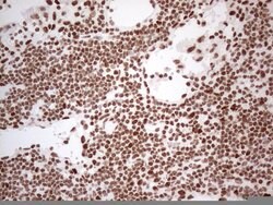 HNRNPL Monoclonal Antibody (OTI4E5), TrueMAB , OriGene 100 &mu;L; Unconjugated:Antibodies,