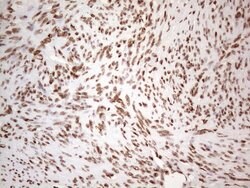 HNRNPL Monoclonal Antibody (OTI4E5), TrueMAB , OriGene 100 &mu;L; Unconjugated:Antibodies,