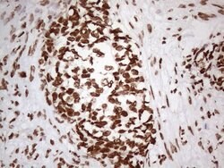 HNRNPL Monoclonal Antibody (OTI4E5), TrueMAB , OriGene 100 &mu;L; Unconjugated:Antibodies,