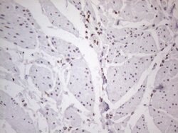 HNRNPL Monoclonal Antibody (OTI4E5), TrueMAB , OriGene 100 &mu;L; Unconjugated:Antibodies,