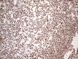 HNRNPL Monoclonal Antibody (OTI4E5), TrueMAB , OriGene 100 &mu;L; Unconjugated:Antibodies,