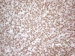 HNRNPL Monoclonal Antibody (OTI4E5), TrueMAB , OriGene 100 &mu;L; Unconjugated:Antibodies,