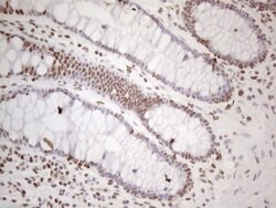 HNRNPL Monoclonal Antibody (OTI4E5), TrueMAB , OriGene 100 &mu;L; Unconjugated:Antibodies,