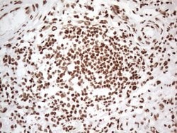 HNRNPL Monoclonal Antibody (OTI4E5), TrueMAB , OriGene 100 &mu;L; Unconjugated:Antibodies,