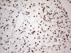 HNRNPL Monoclonal Antibody (OTI4E5), TrueMAB , OriGene 100 &mu;L; Unconjugated:Antibodies,