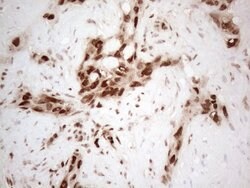 HNRNPL Monoclonal Antibody (OTI4E5), TrueMAB , OriGene 100 &mu;L; Unconjugated:Antibodies,