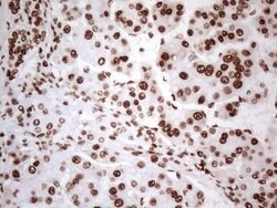 HNRNPL Monoclonal Antibody (OTI4E5), TrueMAB , OriGene 100 &mu;L; Unconjugated:Antibodies,