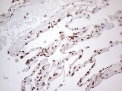 HNRNPL Monoclonal Antibody (OTI4E5), TrueMAB , OriGene 100 &mu;L; Unconjugated:Antibodies,