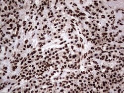 HNRNPL Monoclonal Antibody (OTI9F11), TrueMAB , OriGene 100 &mu;L; Unconjugated:Antibodies,