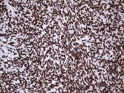 HNRNPL Monoclonal Antibody (OTI9F11), TrueMAB , OriGene 100 &mu;L; Unconjugated:Antibodies,