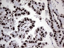 HNRNPL Monoclonal Antibody (OTI9F11), TrueMAB , OriGene 100 &mu;L; Unconjugated:Antibodies,