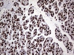 HNRNPL Monoclonal Antibody (OTI9F11), TrueMAB , OriGene 100 &mu;L; Unconjugated:Antibodies,