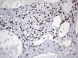HNRNPL Monoclonal Antibody (OTI9F11), TrueMAB , OriGene 100 &mu;L; Unconjugated:Antibodies,