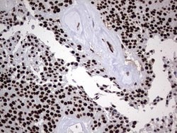HNRNPL Monoclonal Antibody (OTI9F11), TrueMAB , OriGene 100 &mu;L; Unconjugated:Antibodies,