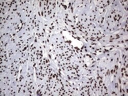 HNRNPL Monoclonal Antibody (OTI9F11), TrueMAB , OriGene 100 &mu;L; Unconjugated:Antibodies,