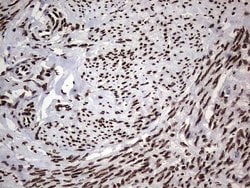 HNRNPL Monoclonal Antibody (OTI9F11), TrueMAB , OriGene 100 &mu;L; Unconjugated:Antibodies,