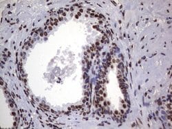 HNRNPL Monoclonal Antibody (OTI9F11), TrueMAB , OriGene 100 &mu;L; Unconjugated:Antibodies,