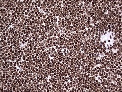HNRNPL Monoclonal Antibody (OTI9F11), TrueMAB , OriGene 100 &mu;L; Unconjugated:Antibodies,