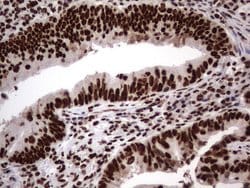 HNRNPL Monoclonal Antibody (OTI9F11), TrueMAB , OriGene 100 &mu;L; Unconjugated:Antibodies,