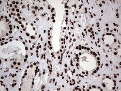 HNRNPL Monoclonal Antibody (OTI9F11), TrueMAB , OriGene 100 &mu;L; Unconjugated:Antibodies,
