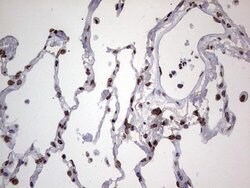 HNRNPL Monoclonal Antibody (OTI9F11), TrueMAB , OriGene 100 &mu;L; Unconjugated:Antibodies,