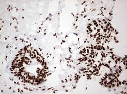 HNRNPM Monoclonal Antibody (OTI3F3), TrueMAB , OriGene 100 &mu;L; Unconjugated:Antibodies,