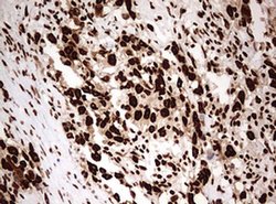 HNRNPM Monoclonal Antibody (OTI3F3), TrueMAB , OriGene 100 &mu;L; Unconjugated:Antibodies,