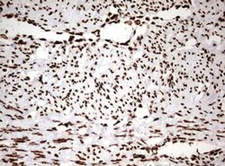 HNRNPM Monoclonal Antibody (OTI3F3), TrueMAB , OriGene 100 &mu;L; Unconjugated:Antibodies,