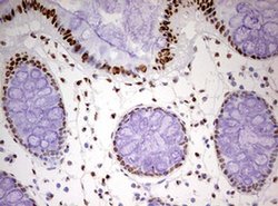 HNRNPM Monoclonal Antibody (OTI3F3), TrueMAB , OriGene 100 &mu;L; Unconjugated:Antibodies,