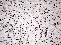 HNRNPM Monoclonal Antibody (OTI3F3), TrueMAB , OriGene 100 &mu;L; Unconjugated:Antibodies,