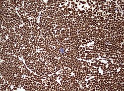 HNRNPM Monoclonal Antibody (OTI3F3), TrueMAB , OriGene 100 &mu;L; Unconjugated:Antibodies,