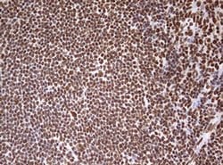HNRNPM Monoclonal Antibody (OTI3F3), TrueMAB , OriGene 100 &mu;L; Unconjugated:Antibodies,