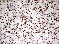 HNRNPM Monoclonal Antibody (OTI3F3), TrueMAB , OriGene 100 &mu;L; Unconjugated:Antibodies,