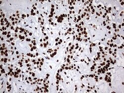 HNRNPM Monoclonal Antibody (OTI1F6), TrueMAB , OriGene 100 &mu;L; Unconjugated:Antibodies,