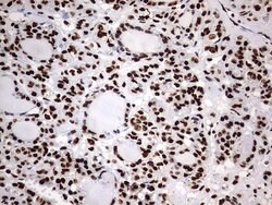 HNRNPM Monoclonal Antibody (OTI1F6), TrueMAB , OriGene 100 &mu;L; Unconjugated:Antibodies,