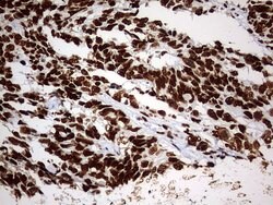 HNRNPM Monoclonal Antibody (OTI1F6), TrueMAB , OriGene 100 &mu;L; Unconjugated:Antibodies,