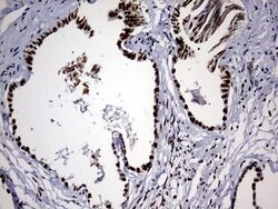 HNRNPM Monoclonal Antibody (OTI1F6), TrueMAB , OriGene 100 &mu;L; Unconjugated:Antibodies,