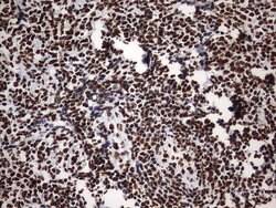 HNRNPM Monoclonal Antibody (OTI1F6), TrueMAB , OriGene 100 &mu;L; Unconjugated:Antibodies,