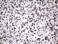 HNRNPM Monoclonal Antibody (OTI1F6), TrueMAB , OriGene 100 &mu;L; Unconjugated:Antibodies,