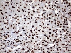 HNRNPM Monoclonal Antibody (OTI1F6), TrueMAB , OriGene 100 &mu;L; Unconjugated:Antibodies,