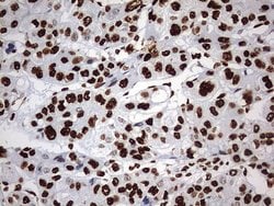 HNRNPM Monoclonal Antibody (OTI1F6), TrueMAB , OriGene 100 &mu;L; Unconjugated:Antibodies,