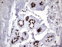 HNRNPM Monoclonal Antibody (OTI4C9), TrueMAB , OriGene 100 &mu;L; Unconjugated:Antibodies,