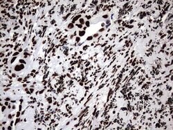 HNRNPM Monoclonal Antibody (OTI4C9), TrueMAB , OriGene 100 &mu;L; Unconjugated:Antibodies,
