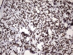 HNRNPM Monoclonal Antibody (OTI4C9), TrueMAB , OriGene 100 &mu;L; Unconjugated:Antibodies,