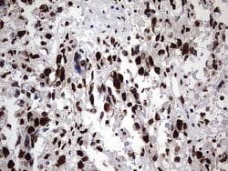 HNRNPM Monoclonal Antibody (OTI4C9), TrueMAB , OriGene 100 &mu;L; Unconjugated:Antibodies,