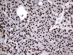 HNRNPM Monoclonal Antibody (OTI4C9), TrueMAB , OriGene 100 &mu;L; Unconjugated:Antibodies,