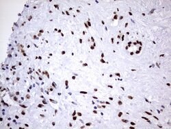 HNRNPM Monoclonal Antibody (OTI4C9), TrueMAB , OriGene 100 &mu;L; Unconjugated:Antibodies,