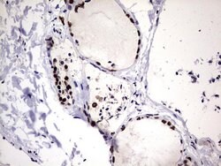 HNRNPM Monoclonal Antibody (OTI4C9), TrueMAB , OriGene 100 &mu;L; Unconjugated:Antibodies,
